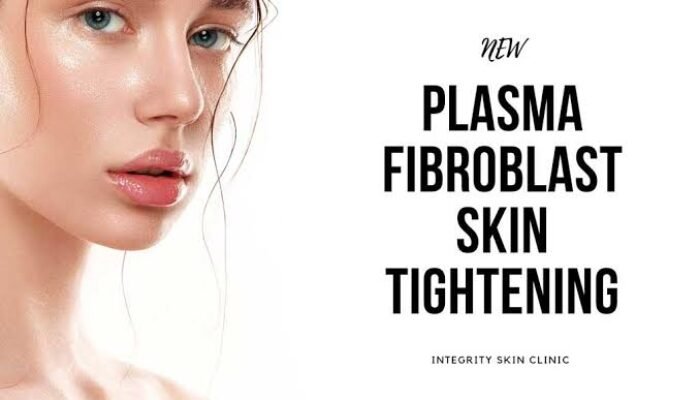 Plasma Fibroblast, Perawatan Wajah Idaman Para Wanita