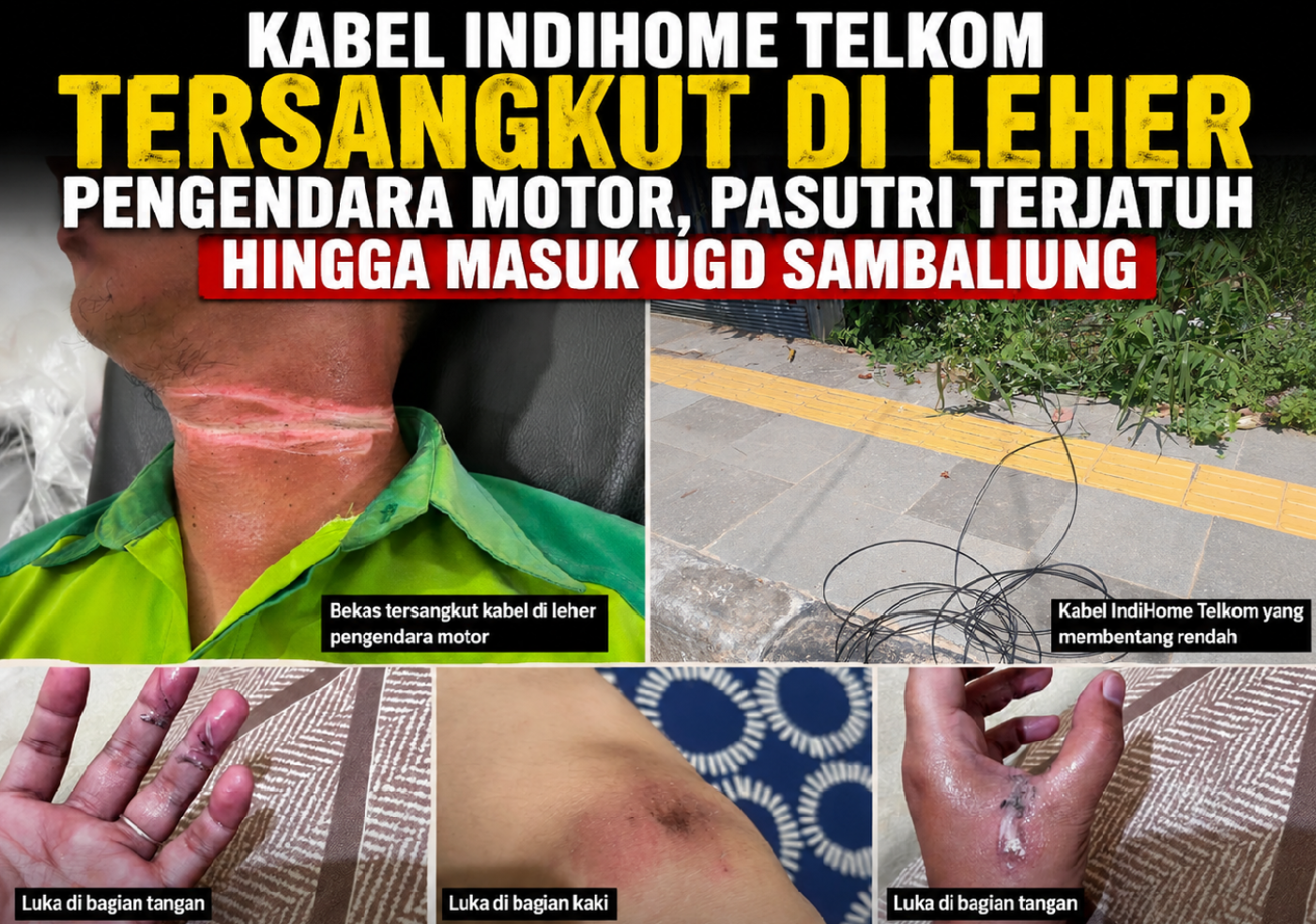 Kabel IndiHome Telkom Membentang di Jalan,Tersangkut di Leher Pengendara Motor, Pasutri Terjatuh hingga Masuk UGD